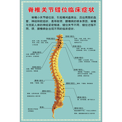 医院医学骨科挂图 脊椎错位的临床症状 PVC高清写真定做海报宣传
